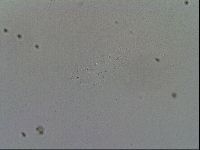 Mesobiotus furciger image