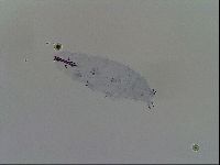 Mesobiotus furciger image