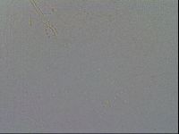 Mesobiotus furciger image