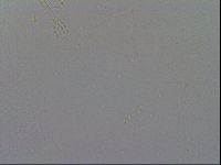 Mesobiotus furciger image