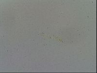 Mesobiotus furciger image