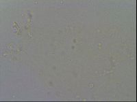 Mesobiotus furciger image