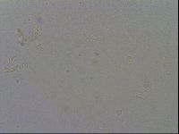 Mesobiotus furciger image