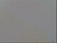 Mesobiotus furciger image