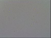Mesobiotus furciger image