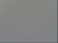 Mesobiotus furciger image