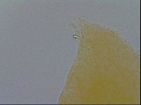 Mesobiotus furciger image