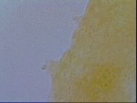 Mesobiotus furciger image