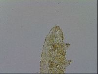 Mesobiotus furciger image