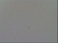 Mesobiotus furciger image