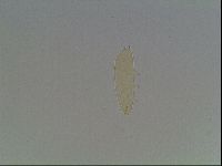 Mesobiotus furciger image