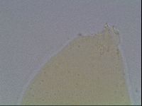 Mesobiotus furciger image