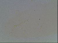 Mesobiotus furciger image