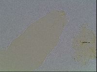 Mesobiotus furciger image
