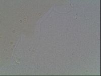 Mesobiotus furciger image