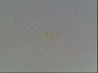 Mesobiotus furciger image