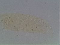 Mesobiotus furciger image
