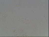 Mesobiotus furciger image