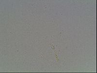 Mesobiotus furciger image
