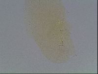 Mesobiotus furciger image
