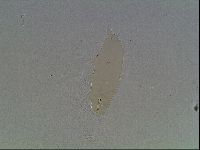 Mesobiotus furciger image