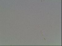 Mesobiotus furciger image