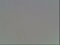 Mesobiotus furciger image