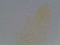 Mesobiotus furciger image