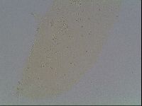 Mesobiotus furciger image