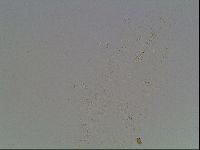 Mesobiotus furciger image