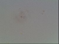 Mesobiotus furciger image