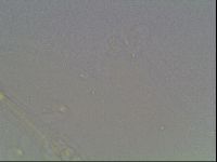Mesobiotus furciger image