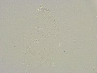 Mesobiotus furciger image