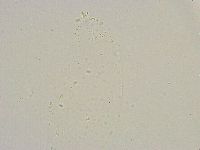 Mesobiotus furciger image