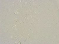 Mesobiotus furciger image