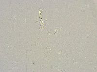 Mesobiotus furciger image