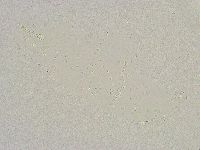 Mesobiotus furciger image