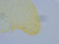 Macrobiotus grandis image