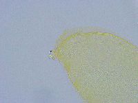 Macrobiotus grandis image