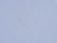 Thulinius saltursus image