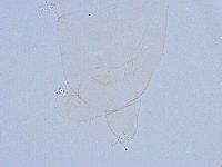 Thulinius saltursus image