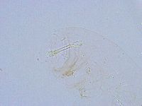 Thulinius saltursus image
