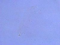 Thulinius saltursus image