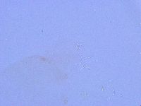 Thulinius saltursus image