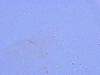 Thulinius saltursus image
