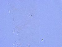 Thulinius saltursus image