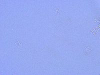 Thulinius saltursus image