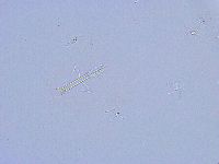 Thulinius saltursus image