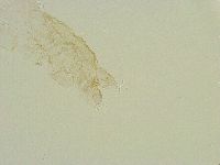 Thulinius saltursus image