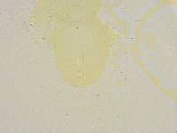 Thulinius saltursus image